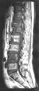 140612-AK-CT-Spine-幅300