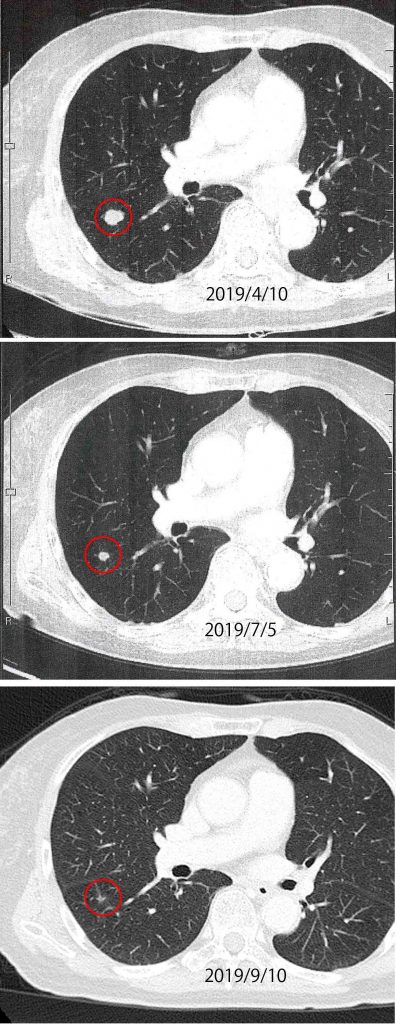 190410〜0910-KS29ChestCT2低解像度
